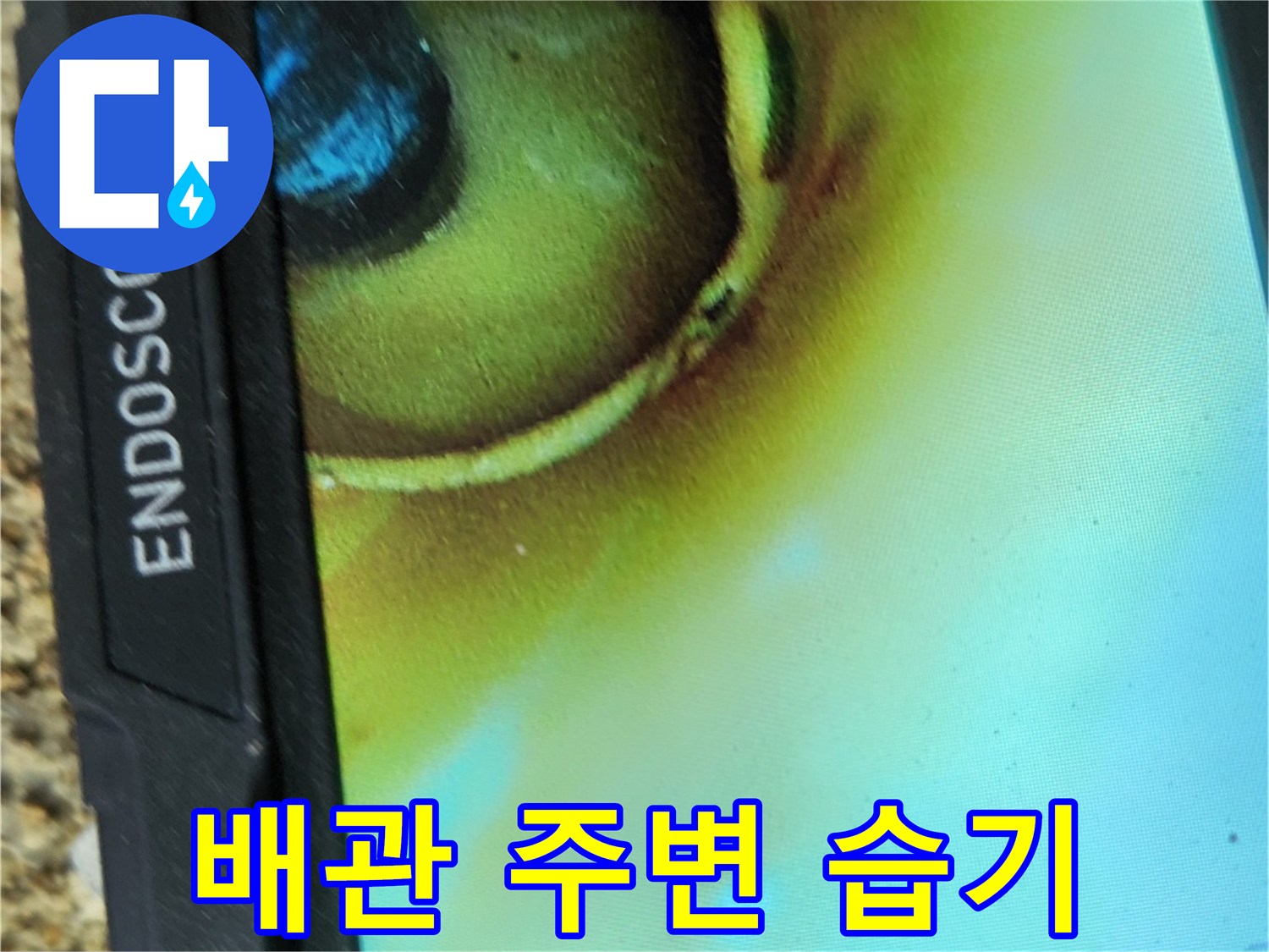 내시경으로-포착한-배관 주변의-습윤한 상태